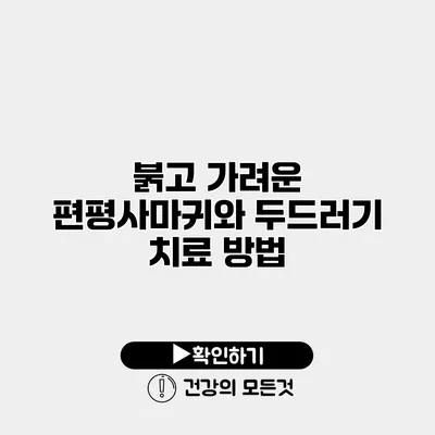 붉고 가려운 편평사마귀와 두드러기 치료 방법